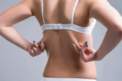 Reduce Back Fat & Bra Fat with CoolSculpting in Creve Coeur MO | Eternity Med Spa in greater St Louis area